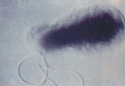 Bartonella