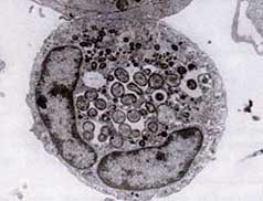 3-phagocytophilum