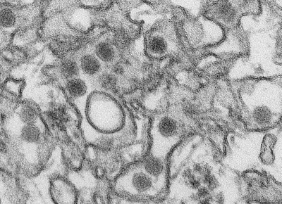 zika-virus