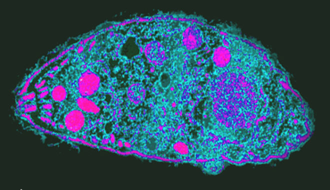 Toxoplasma-gondii-660x380