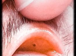 636354599974837121-jcoyle-eye