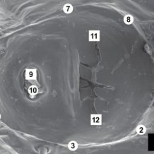 Dermacentor-variabilis-Hallers-organ