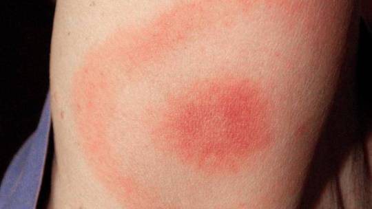 B97808243Z.120180615163154000GK8L2CS6.11