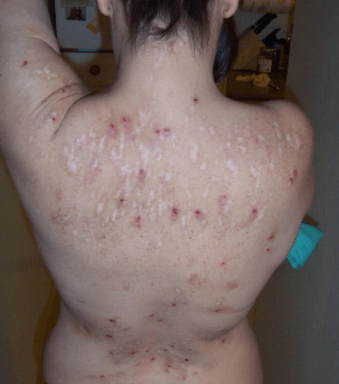 Screenshot_2018-11-16 MorgFig2 pdf