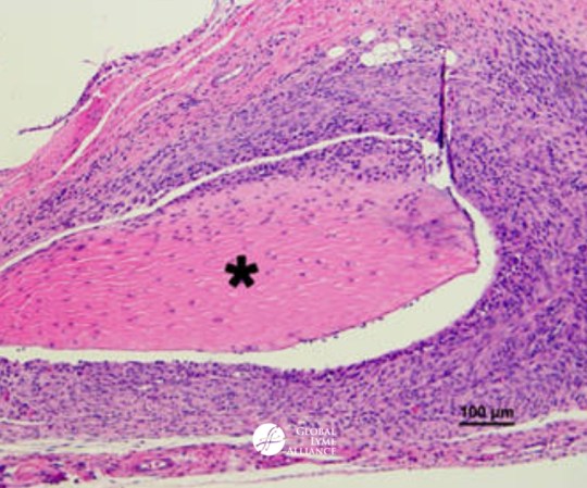 borrelia-burgdorferi_mice