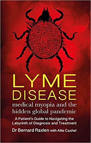 51qYZzBhxjL._SX316_BO1,204,203,200_